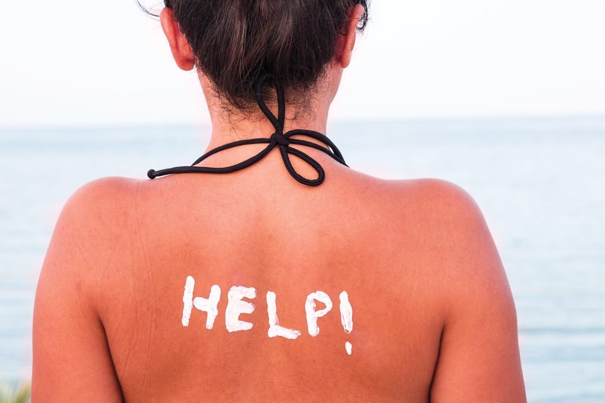 Những điều bạn cần tránh khi làn da bị cháy nắng